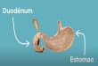 Médicament ulcère estomac sans ordonnance