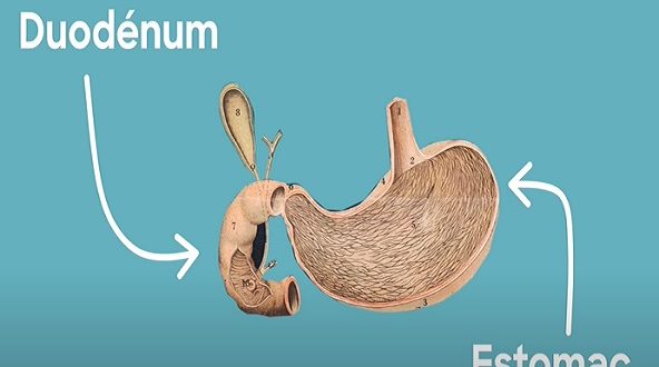 Médicament ulcère estomac sans ordonnance